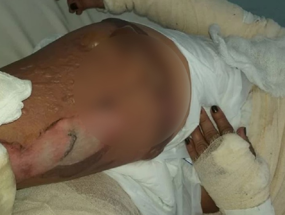 Crueldade: Homem que tocou fogo na esposa é preso em Manacapuru
