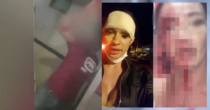 Escândalo: Médico quebra nariz de homossexual após ter fetiche negado; veja vídeo