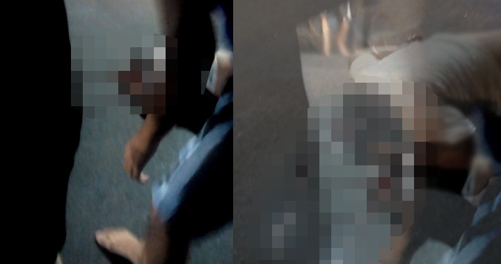 Motoqueiro tem cabeça escalpelada ao fazer ‘cavalinho de pau’, em Manaus; imagens fortes