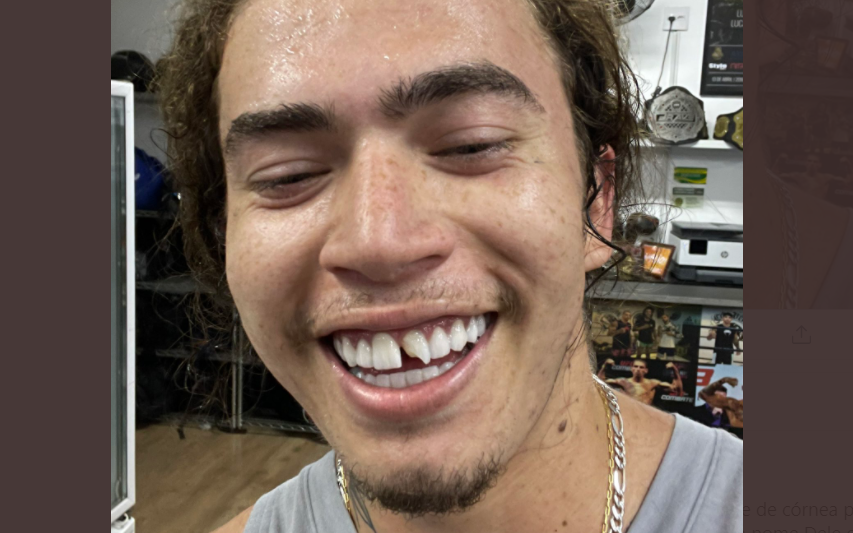 Whindersson Nunes quebra o dente durante treino e gera risada na web