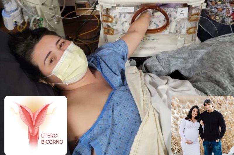 Milagre: mãe dá à luz gêmeos após sofrer 10 abortos espontâneos por deformação no útero: 'chance 1 em 50 milhões'