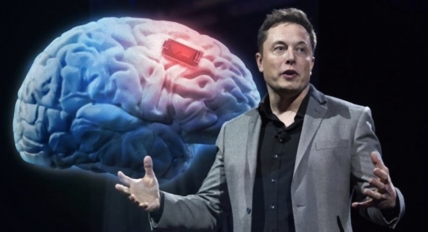Elon Musk quer fazer dinheiro implantando chips no cérebro das pessoas